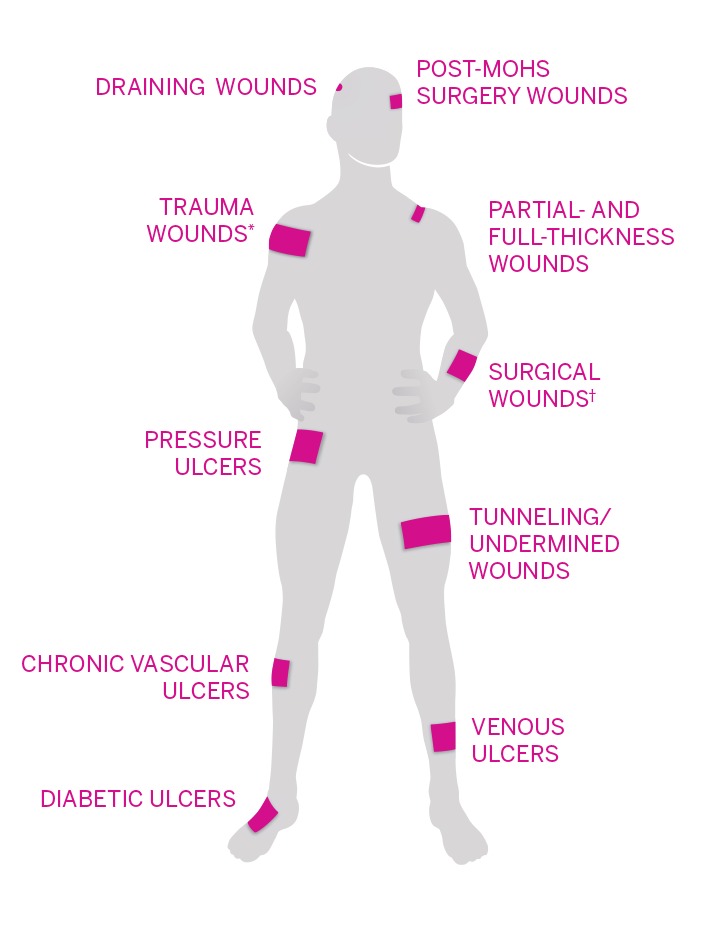Get Your Experienced Nurses for Wound Care at Home|Drugcarts Get Your Experienced Nurses for Wound Care at Home|Drugcarts